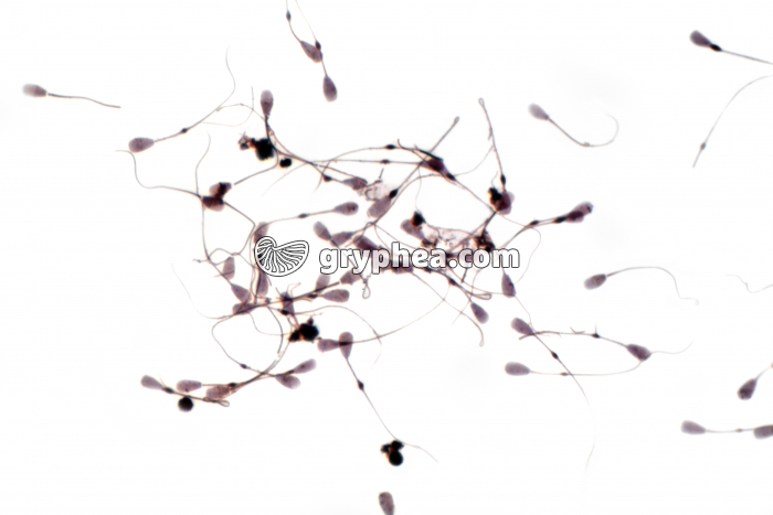 Spermatozoïdes de Taureau x170 - gryphea.com